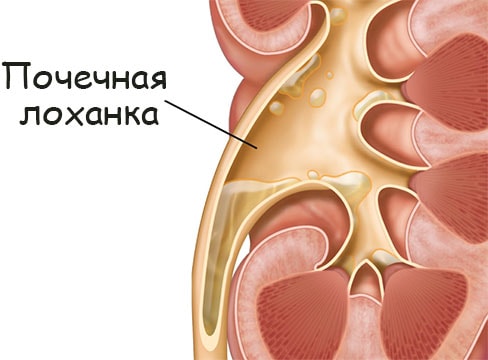 Как восстановить кракен